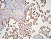 IHC staining of FFPE human placenta with HOOK3 antibody at 1ug/ml. HIER: boil tissue sections in pH6, 10mM citrate buffer, for 10-20 min and allow to cool before testing.