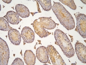 IHC staining of FFPE mouse testis with HOOK3 antibody at 1ug/ml. HIER: boil tissue sections in pH6, 10mM citrate buffer, for 10-20 min and allow to cool before testing.