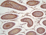 IHC staining of FFPE rat testis with HOOK3 antibody at 1ug/ml. HIER: boil tissue sections in pH6, 10mM citrate buffer, for 10-20 min and allow to cool before testing.