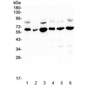 Western blot testing of human 1) U-87 MG, 2) A431, 3) HL-60, 4) K562, 5) ThP-1 and 6) HeLa lysate with EGFL6 antibody at 0.5ug/ml. Predicted molecular weight ~62 kDa.