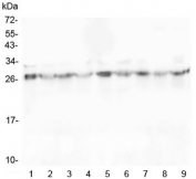 Western blot testing of 1) rat brain, 2) rat heart, 3) rat spleen, 4) rat kidney, 5) mouse brain, 6) mouse heart, 7) mouse spleen, 8) mouse kidney and 9) mouse Neuro-2a lysate with SCN4B antibody at 0.5ug/ml. Predicted molecular weight: 25-38 kDa depending on level of glycosylation.