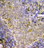 IHC staining of FFPE rat spleen with SCN4B antibody at 1ug/ml. HIER: boil tissue sections in pH6, 10mM citrate buffer, for 10-20 min and allow to cool before testing.