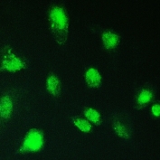 IF/ICC staining of FFPE human A549 cells with KBTBD2 antibody at 2ug/ml. HIER: steam section in pH6 citrate buffer for 20 min.