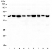 Western blot testing of 1) rat brain, 2) rat heart, 3) rat kidney, 4) rat ovary, 5) mouse brain, 6) mouse heart, 7) mouse kidney, 8) mouse testis and 9) mouse SP2/0 lysate with KBTBD2 antibody at 0.5ug/ml. Predicted molecular weight ~71 kDa.