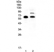 Western blot testing of human 1) placenta and 2) HL-60 lysate with CCDC36 antibody at 0.5ug/ml. Predicted molecular weight ~66 kDa.