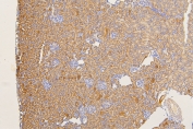 IHC staining of FFPE mouse kidney with SFRP1 antibody at 1ug/ml. HIER: boil tissue sections in pH6, 10mM citrate buffer, for 10-20 min and allow to cool before testing.