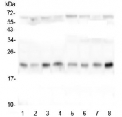 Western blot testing of human 1) HeLa, 2) placenta, 3) Caco-2, 4) T-47D, 5) U-87 MG, 6) K562, 7) U-2 OS and 8) PC-3 lysate with TMEM199 antibody at 0.5ug/ml. Predicted molecular weight ~23 kDa.