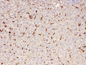 IHC staining of FFPE mouse liver with MRP2 antibody at 1ug/ml. HIER: boil tissue sections in pH6, 10mM citrate buffer, for 10-20 min and allow to cool before testing.