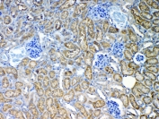 IHC staining of FFPE mouse kidney with MRP2 antibody at 1ug/ml. HIER: boil tissue sections in pH6, 10mM citrate buffer, for 10-20 min and allow to cool before testing.