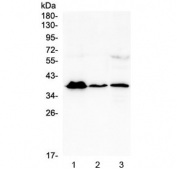 Western blot testing of human 1) T-47D, 2) U937 and 3) A431 cell lysate with MR1 antibody at 0.5ug/ml. Predicted molecular weight ~39 kDa.