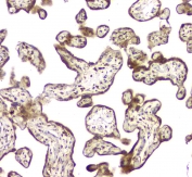 IHC staining of FFPE human placenta tissue with MCUR1 antibody at 1ug/ml. HIER: boil tissue sections in pH6, 10mM citrate buffer, for 10-20 min and allow to cool before testing.