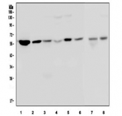 Western blot testing of 1) human U-87 MG, 2) human U-2 OS, 3) human placenta, 4) human HeLa, 5) human A549, 6) human K562, 7) rat C6 and 8) mouse Neuro-2a cell lysate with OPTN antibody. Expected molecular weight: 66-74 kDa depending on phosphorylation level.