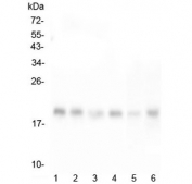 Western blot testing of human 1) HeLa, 2) T-47D, 3) HepG2, 4) K562, 5) mouse liver and 6) mouse HEPA1-6 lysate with RMI2 antibody at 0.5ug/ml. Expected molecular weight ~18 kDa.