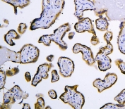 IHC staining of FFPE human placenta tissue with HOOK2 antibody. HIER: boil tissue sections in pH8 EDTA buffer, for 10-20 min and allow to cool before testing.
