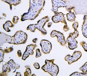 IHC staining of FFPE human placenta tissue with HOOK2 antibody. HIER: boil tissue sections in pH8 EDTA buffer, for 10-20 min and allow to cool before testing.