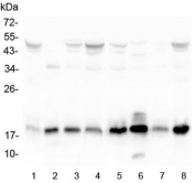 Western blot testing of human 1) placenta, 2) K562, 3) T-47D, 4) Caco-2, 5) HeLa, 6) ThP-1, 7) A431 and 8) A549 lysate with TIMM17A antibody at 0.5ug/ml. Predicted molecular weight ~18 kDa.