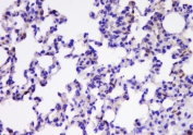 IHC staining of FFPE rat lung with TIMM17A antibody at 1ug/ml. HIER: boil tissue sections in pH6, 10mM citrate buffer, for 10-20 min and allow to cool before testing.