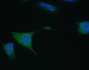 IF/ICC staining of FFPE human A549 cells with TIMM17A antibody (green) at 2ug/ml and DAPI nuclear stain (blue). HIER: steam section in pH6 citrate buffer for 20 min.