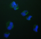 IF/ICC staining of FFPE human HeLa cells with TIMM17A antibody (green) at 2ug/ml and DAPI nuclear stain (blue). HIER: steam section in pH6 citrate buffer for 20 min.