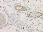 IHC staining of FFPE human appendicitis tissue with SRCIN1 antibody at 1ug/ml. HIER: boil tissue sections in pH6, 10mM citrate buffer, for 10-20 min and allow to cool before testing.