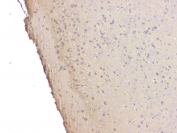 IHC staining of FFPE mouse brain with SRCIN1 antibody at 1ug/ml. HIER: boil tissue sections in pH6, 10mM citrate buffer, for 10-20 min and allow to cool before testing.