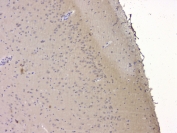 IHC staining of FFPE rat brain with SRCIN1 antibody at 1ug/ml. HIER: boil tissue sections in pH6, 10mM citrate buffer, for 10-20 min and allow to cool before testing.