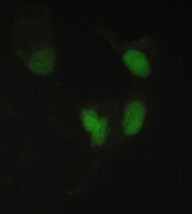 IF/ICC staining of FFPE human A431 cells with PPCS antibody (green) at 2ug/ml. HIER: steam section in pH6 citrate buffer for 20 min.