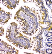 IHC staining of FFPE rat small intestine with PPCS antibody at 1ug/ml. HIER: boil tissue sections in pH6, 10mM citrate buffer, for 10-20 min and allow to cool before testing.