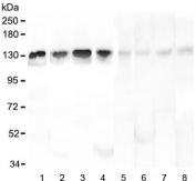 Western blot testing of human 1) HL-60, 2) K562, 3) ThP-1, 4) Caco-2, 5) rat liver, 6) mouse brain, 7) mouse liver and 8) mouse NIH3T3 lysate with Leucyl tRNA synthetase antibody at 0.5ug/ml. Predicted molecular weight ~134 kDa.