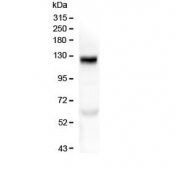 Western blot testing of human placenta with COL17A1 antibody at 0.5ug/ml. Expected molecular weight ~120 kDa and ~180 kDa.