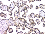 IHC staining of FFPE human placental tissue with HDAC5 antibody at 1ug/ml. HIER: boil tissue sections in pH6, 10mM citrate buffer, for 10-20 min and allow to cool before testing.