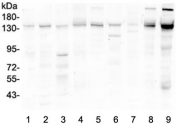 Western blot testing of 1) rat heart, 2) rat liver, 3) rat stomach, 4) rat ovary, 5) mouse heart, 6) mouse liver, 7) mouse stomach, 8) mouse ovary and 9) mouse NIH3T3 lysate with HDAC5 antibody at 0.5ug/ml. Predicted molecular weight ~122 kDa, observed at 122-160 kDa.