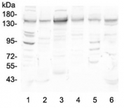 Western blot testing of human 1) HeLa, 2) placenta, 3) ThP-1, 4) K562, 5) PC-3 and 6) Caco-2 lysate with HDAC5 antibody at 0.5ug/ml. Predicted molecular weight ~122 kDa, observed at 122-160 kDa.