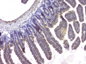 IHC staining of FFPE mouse intestine with HDAC5 antibody at 1ug/ml. HIER: boil tissue sections in pH6, 10mM citrate buffer, for 10-20 min and allow to cool before testing.