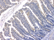 IHC staining of FFPE rat intestine with HDAC5 antibody at 1ug/ml. HIER: boil tissue sections in pH6, 10mM citrate buffer, for 10-20 min and allow to cool before testing.