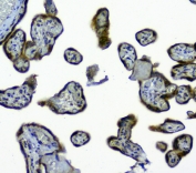 IHC staining of FFPE human placental tissue with SIRT4 antibody at 1ug/ml. HIER: boil tissue sections in pH6, 10mM citrate buffer, for 10-20 min and allow to cool before testing.