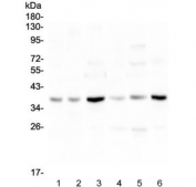 Western blot testing of 1) rat brain, 2) rat heart, 3) rat liver, 4) mouse brain, 5) mouse heart and 6) mouse liver lysate with SIRT4 antibody at 0.5ug/ml. Predicted molecular weight ~35 kDa.