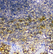 IHC staining of FFPE human tonsil with SIRT4 antibody at 1ug/ml. HIER: boil tissue sections in pH6, 10mM citrate buffer, for 10-20 min and allow to cool before testing.