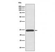 Western blot testing of human placenta lysate with Growth Hormone antibody. Predicted molecular weight: 22-25 kDa.