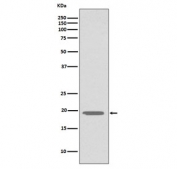 Western blot testing of human HepG2 cell lysate with Glucagon antibody. Predicted molecular weight ~21 kDa (pro form).
