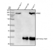 Immunoprecipitation of ARID2 protein from 500ug of human MCF7 whole cell lysate with 2ug of ARID2 antibody.