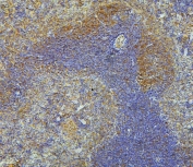 IHC staining of FFPE mouse spleen with ARPC1B antibody. HIER: boil tissue sections in pH6, 10mM citrate buffer, for 20 min and allow to cool before testing.