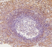 IHC staining of FFPE human tonsil with ARPC1B antibody. HIER: boil tissue sections in pH6, 10mM citrate buffer, for 20 min and allow to cool before testing.