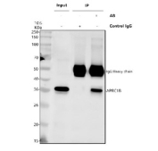Immunoprecipitation of ARPC1B protein from 500ug of human HeLa whole cell lysate with 2ug of ARPC1B antibody.