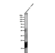 Western blot testing of recombinant human partial IL1 beta protein with IL1B antibody.