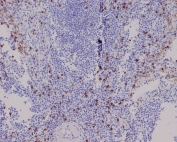 IHC staining of FFPE human spleen tissue with CD8 alpha antibody. HIER: boil tissue sections in pH6, 10mM citrate buffer, for 10-20 min and allow to cool before testing.