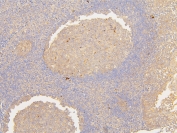 IHC staining of FFPE human tonsil with ATP5MC1/2/3 antibody. HIER: boil tissue sections in pH6, 10mM citrate buffer, for 20 min and allow to cool before testing.