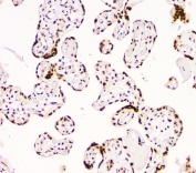 IHC staining of FFPE human placenta with BCL9L antibody. HIER: boil tissue sections in pH6, 10mM citrate buffer, for 20 min and allow to cool before testing.