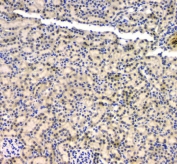 IHC staining of FFPE mouse kidney with BCL9L antibody. HIER: boil tissue sections in pH6, 10mM citrate buffer, for 20 min and allow to cool before testing.