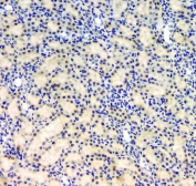 IHC staining of FFPE rat kidney with BCL9L antibody. HIER: boil tissue sections in pH6, 10mM citrate buffer, for 20 min and allow to cool before testing.